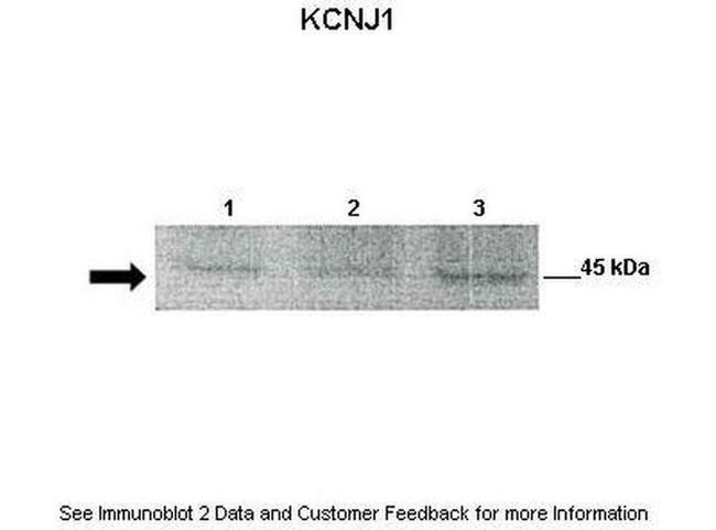Kir1.1 (KCNJ1) Antibody in Western Blot (WB)