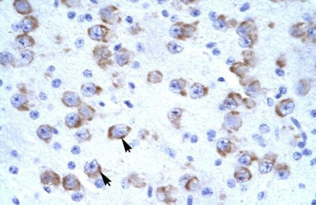 CATSPER2 Antibody in Immunohistochemistry (IHC)