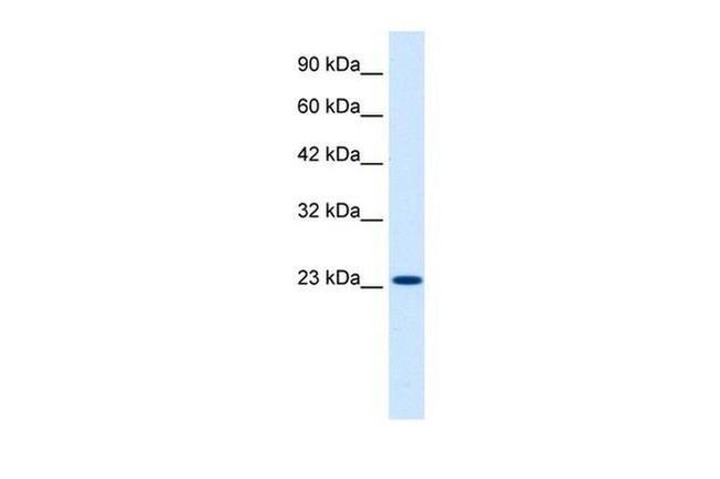 KChIP2 Antibody in Western Blot (WB)