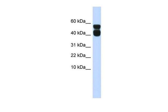 P2X4 Antibody in Western Blot (WB)