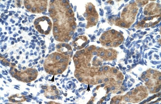 GluR6 Antibody in Immunohistochemistry (IHC)