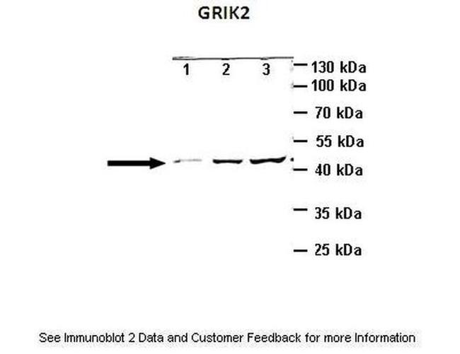 GluR6 Antibody in Western Blot (WB)