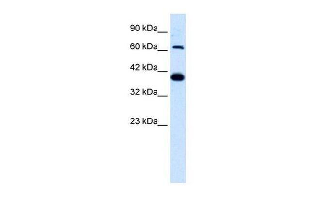 GluR6 Antibody in Western Blot (WB)