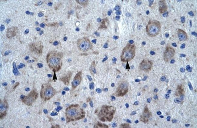 KCTD13 Antibody in Immunohistochemistry (IHC)