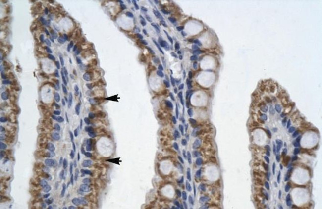 PITX2 Antibody in Immunohistochemistry (IHC)