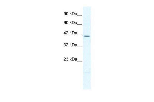 PITX2 Antibody in Western Blot (WB)