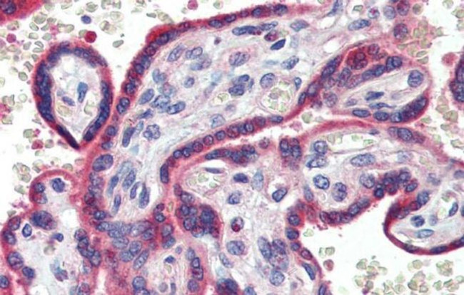 ZNF165 Antibody in Immunohistochemistry (IHC)