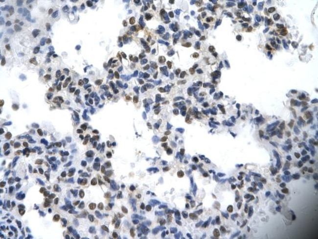 ILF2 Antibody in Immunohistochemistry (Paraffin) (IHC (P))