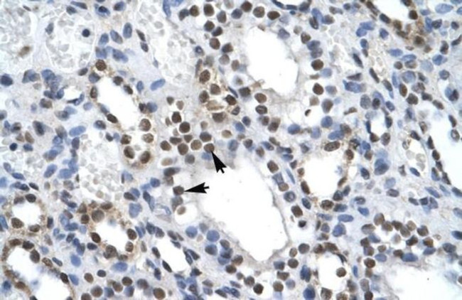 ILF2 Antibody in Immunohistochemistry (Paraffin) (IHC (P))