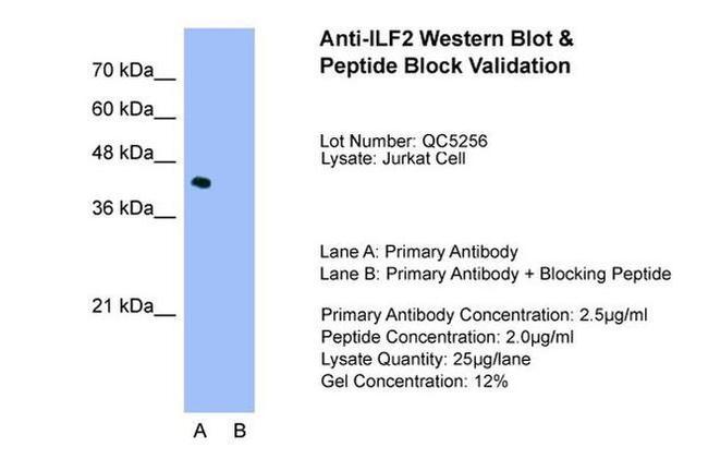 ILF2 Antibody in Western Blot (WB)