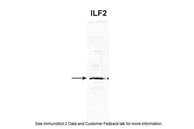 ILF2 Antibody in Western Blot (WB)