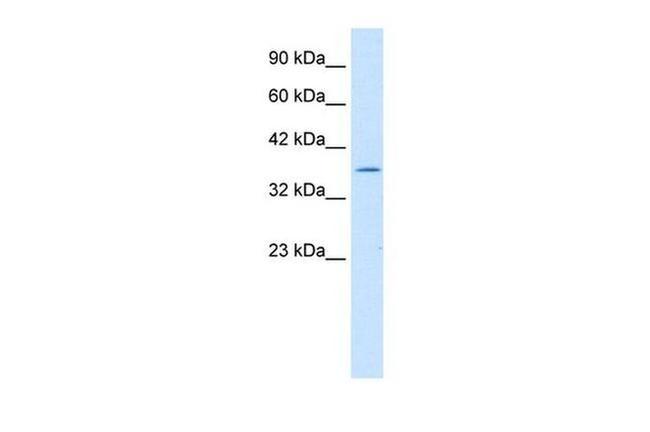 ILF2 Antibody in Western Blot (WB)