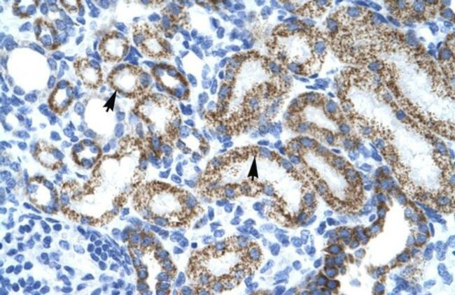 L-Myc Antibody in Immunohistochemistry (IHC)