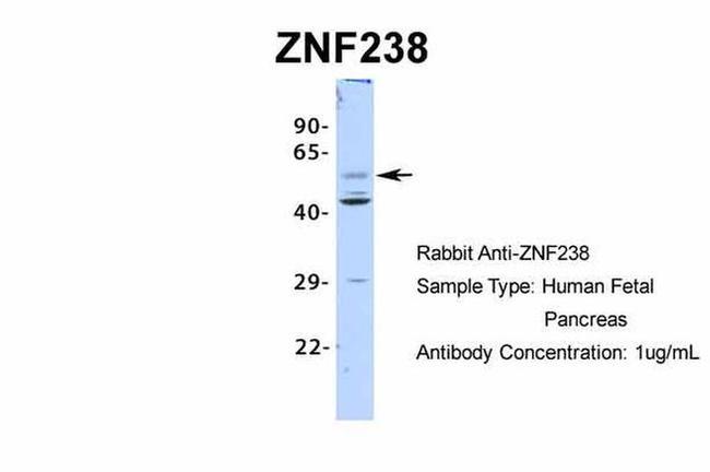 ZNF238 Antibody in Western Blot (WB)