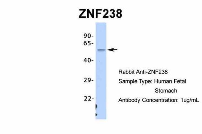 ZNF238 Antibody in Western Blot (WB)