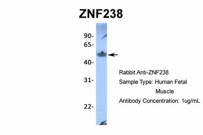 ZNF238 Antibody in Western Blot (WB)