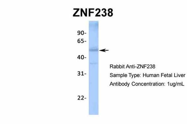 ZNF238 Antibody in Western Blot (WB)