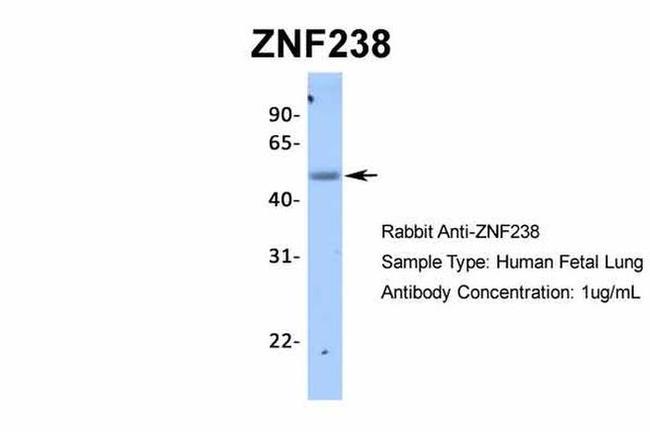 ZNF238 Antibody in Western Blot (WB)