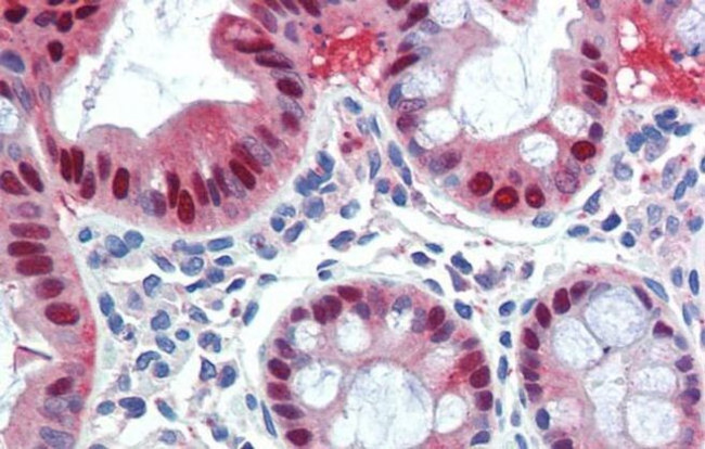 SCML1 Antibody in Immunohistochemistry (IHC)