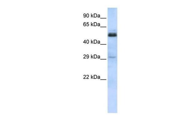 SCML1 Antibody in Western Blot (WB)