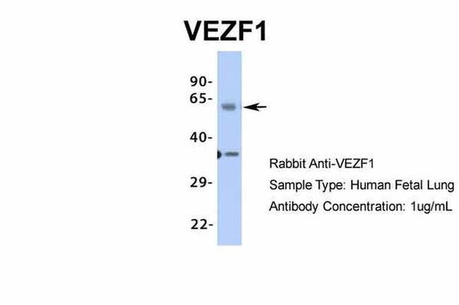 VEZF1 Antibody in Western Blot (WB)