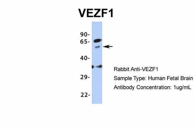 VEZF1 Antibody in Western Blot (WB)