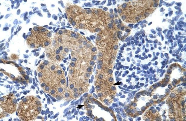 GTF3C5 Antibody in Immunohistochemistry (IHC)