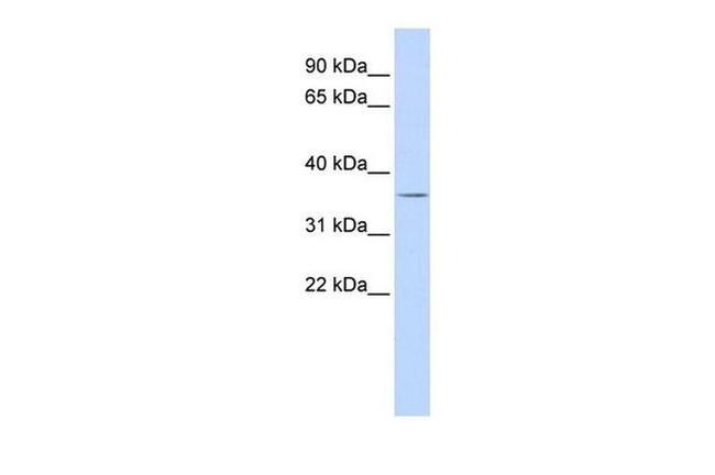 VSX1 Antibody in Western Blot (WB)