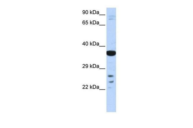 VSX1 Antibody in Western Blot (WB)