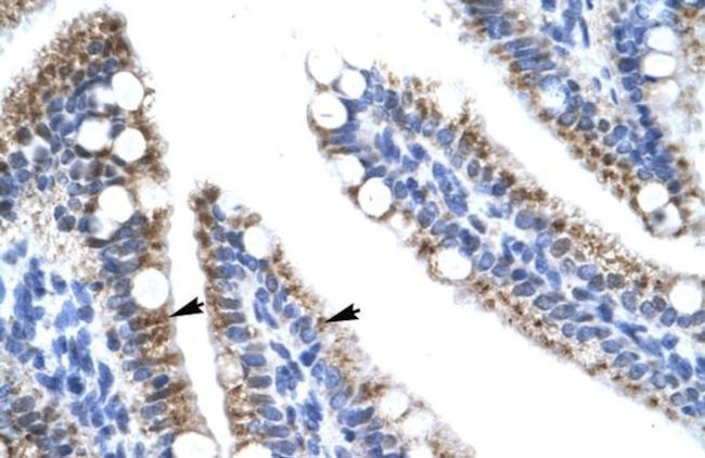 ZNF12 Antibody in Immunohistochemistry (IHC)