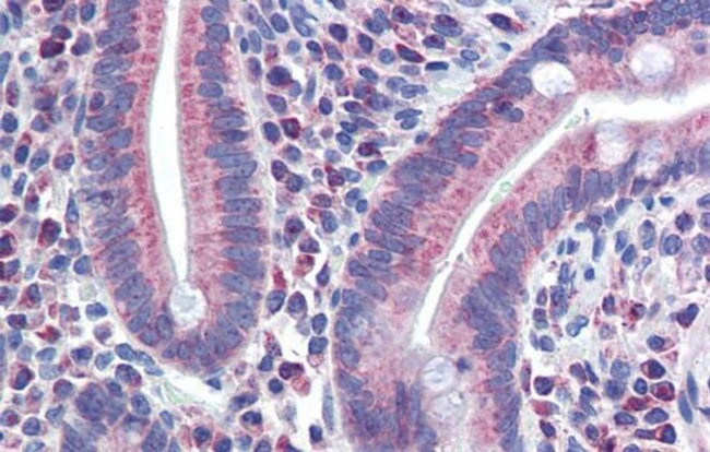 PXR Antibody in Immunohistochemistry (IHC)