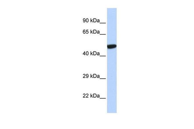 PXR Antibody in Western Blot (WB)