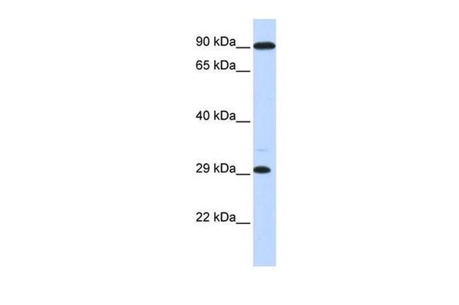 HOXB8 Antibody in Western Blot (WB)