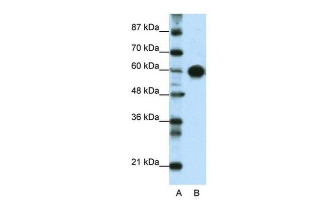 ZSCAN5 Antibody in Western Blot (WB)