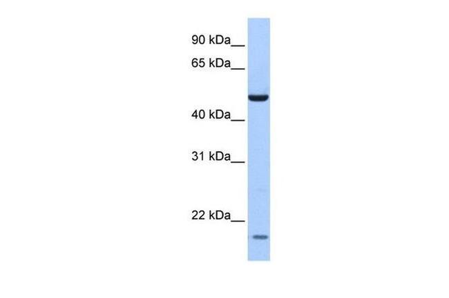 ZNF764 Antibody in Western Blot (WB)