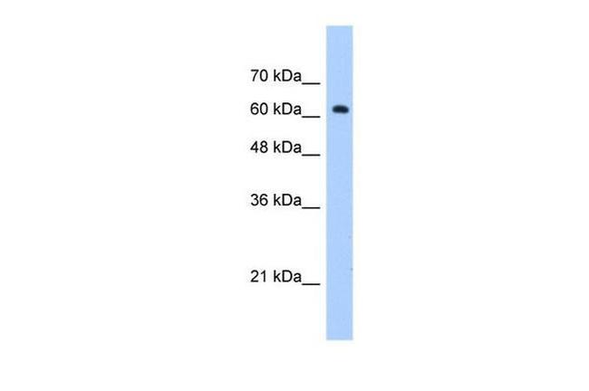 ZNF675 Antibody in Western Blot (WB)