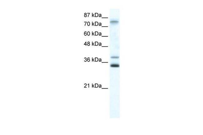 ZNF570 Antibody in Western Blot (WB)
