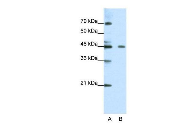 ZNF645 Antibody in Western Blot (WB)