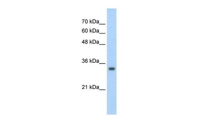 ZNF227 Antibody in Western Blot (WB)