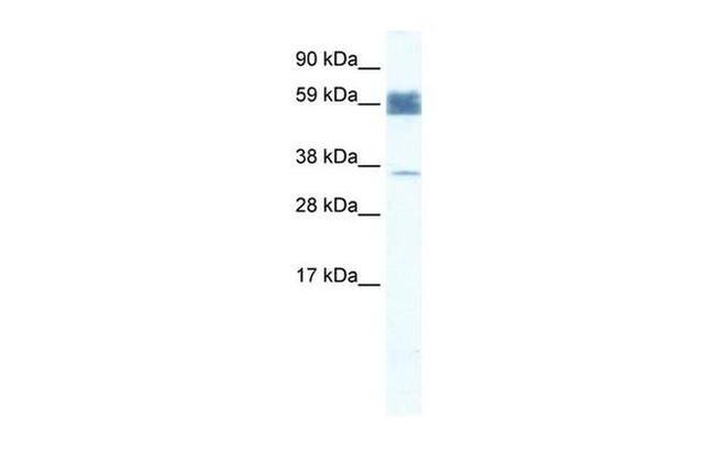 ZNF713 Antibody in Western Blot (WB)