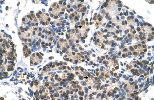 DHX9 Antibody in Immunohistochemistry (IHC)