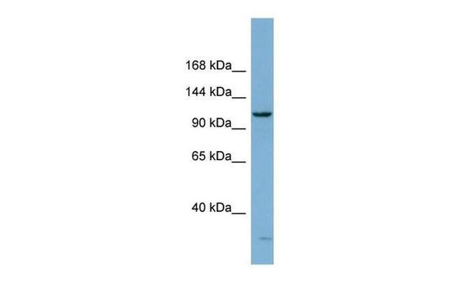 DHX15 Antibody in Western Blot (WB)