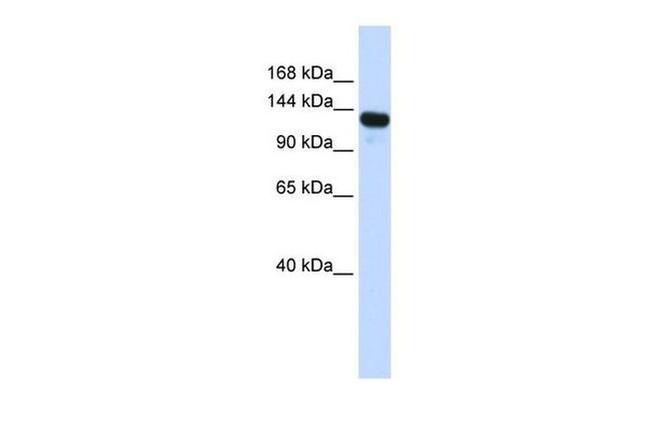 UPF1 Antibody in Western Blot (WB)