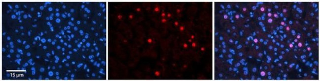 RAD54B Antibody in Immunohistochemistry (Paraffin) (IHC (P))