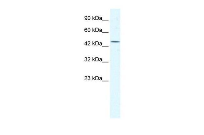 eIF4A3 Antibody in Western Blot (WB)