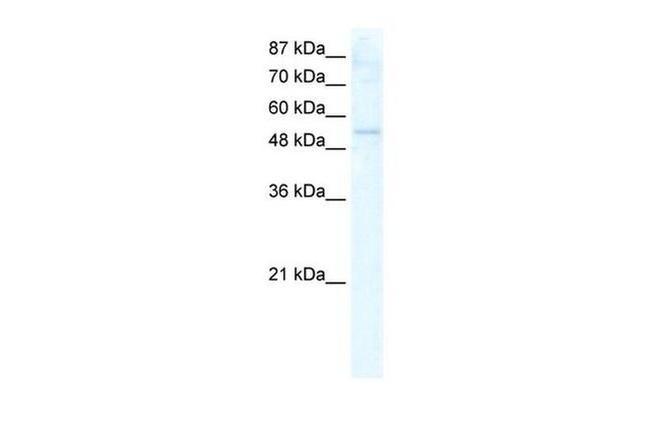 DDX19A Antibody in Western Blot (WB)