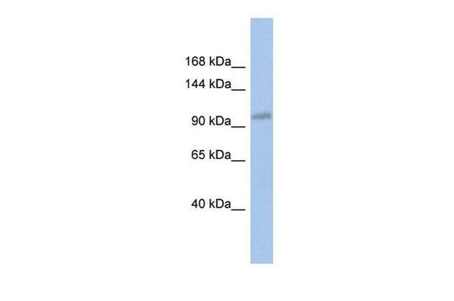 DDX24 Antibody in Western Blot (WB)