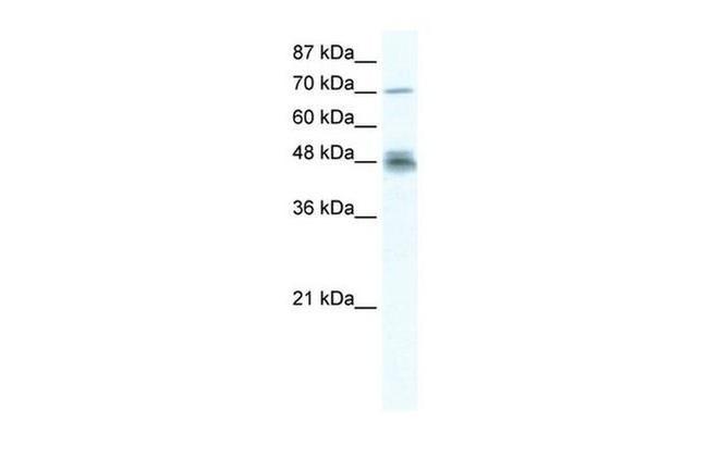 DDX50 Antibody in Western Blot (WB)