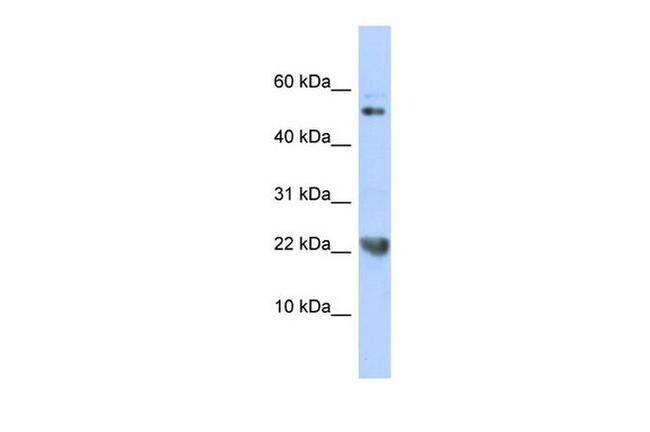 TWEAK Antibody in Western Blot (WB)