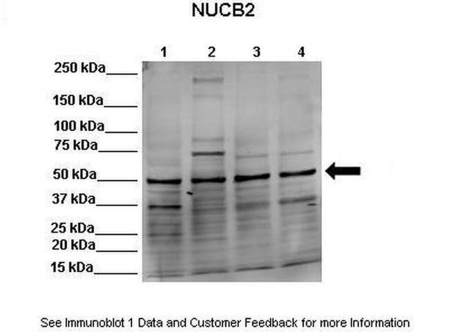 NUCB2 Antibody in Western Blot (WB)